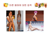 [영양교육] 청소년기 식습관-섭식장애의 이해와 개선-8
