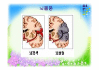 [사회복지] 뇌병변 장애의 판정과 극복-14