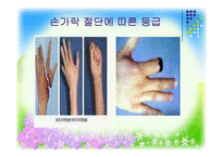 [사회복지] 지체장애의 진단과 극복-14