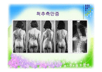 [사회복지] 지체장애의 진단과 극복-18