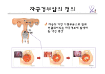 자궁경부암의 원인 및 예방과 치료-3