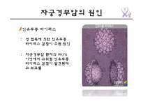 자궁경부암의 원인 및 예방과 치료-11