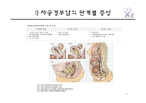자궁경부암의 원인 및 예방과 치료-13