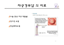 자궁경부암의 원인 및 예방과 치료-19