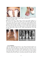 발레용품의 종류와 특징 및 사례들 조사분석-5