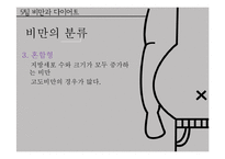 비만과 다이어트-9