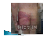 아동학대 대책 발표자료-4