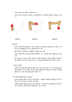 [장애인복지론] 장루 요루 장애-6