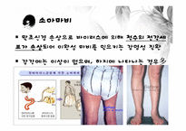 [장애인복지론] 지체장애 원인 및 실태, 치료-5