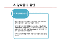 [약과 건강] 강박증-11