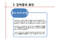[약과 건강] 강박증-16