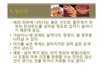 산후조리 레포트-8