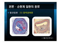 [노인건강과 운동] 노인의 순환계 질환-9