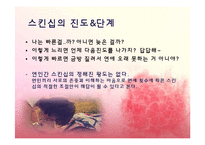 사랑과 스킨십 레포트-8
