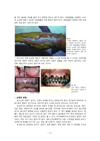 원자력 사고에 의한 영향과 대책-16