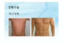 몸담론 레포트-15