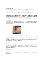 성인간호학4공통)대장암 치료과정에서 장루환자의 간호에 관한 유용한 정보를 조사0k-5