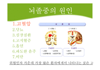 [보건학] 뇌졸중-7