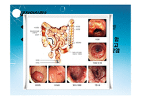 [면역] 대장암 치료를 위한 Anti-EGFR, Anti-VEGF antibody-20