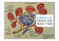 [간호학] 임신성 당뇨(G-DM) 진단과 간호중재-6