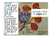 [간호학] 임신성 당뇨(G-DM) 진단과 간호중재-8