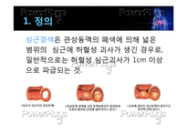 [간호학] 심근경색의 진단 및 간호과정-4