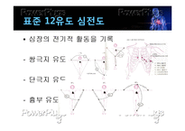 [간호학] 심근경색의 진단 및 간호과정-14