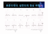 [간호학] 심근경색의 진단 및 간호과정-15