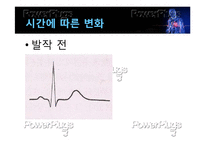 [간호학] 심근경색의 진단 및 간호과정-18
