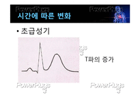 [간호학] 심근경색의 진단 및 간호과정-19