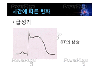 [간호학] 심근경색의 진단 및 간호과정-20