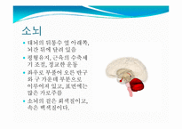 뇌, 신경계 및 관련 질병-13