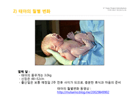 임신과 출산 레포트-8
