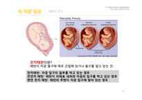 임신과 출산 레포트-11
