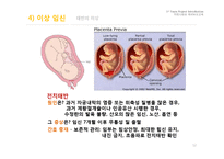 임신과 출산 레포트-12