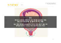 임신과 출산 레포트-14