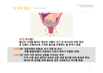 임신과 출산 레포트-15