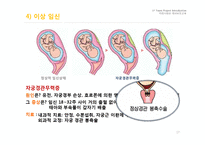 임신과 출산 레포트-17