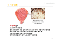 임신과 출산 레포트-20