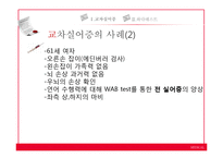 [언어병리] 교차실어증과 언어중추검사(Wada Test)-13
