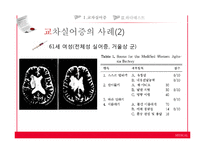[언어병리] 교차실어증과 언어중추검사(Wada Test)-14