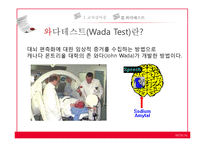 [언어병리] 교차실어증과 언어중추검사(Wada Test)-16