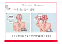 [언어병리] 교차실어증과 언어중추검사(Wada Test)-19