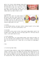 [신경학] 전신성 홍반성 루푸스(Systemic lupus erythematosus)-4
