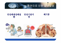 [성인간호학] 폐암의 원인과 흡연의 위험요인-6