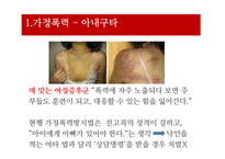 [사회문제론] 가정폭력, 성폭력문제-5