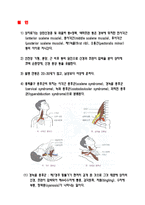 흉곽출구증후근-2