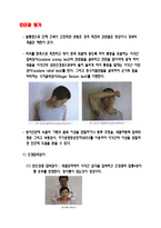 흉곽출구증후근-5
