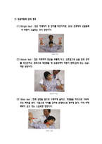 흉곽출구증후근-6