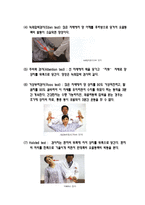 흉곽출구증후근-7